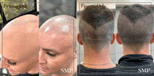 SMP services at Finessed Ink